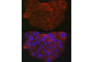 Immunofluorescence analysis of A-431 cells using Collagen I/COL1 antibody (ABIN6134502, ABIN6138839, ABIN6138840 and ABIN6221469) at dilution of 1:25. (COL1A2 anticorps  (AA 500-600))