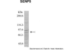 Sample Type: 1. (SENP5 anticorps  (Middle Region))