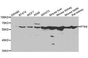 Western blot analysis of extracts of various cell lines, using PTK6 antibody. (PTK6 anticorps  (AA 222-451))
