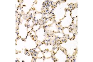 Immunohistochemistry of paraffin-embedded rat lung using SFN Antibody. (14-3-3 sigma/SFN anticorps)