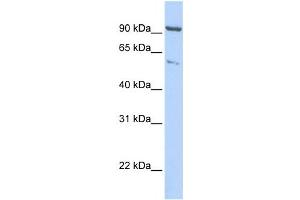 Western Blotting (WB) image for anti-Kinesin Heavy Chain Member 2A (KIF2A) antibody (ABIN2458064) (KIF2A anticorps)