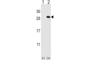 Western Blotting (WB) image for anti-Eukaryotic Translation Initiation Factor 4E Family Member 2 (EIF4E2) antibody (ABIN3001010) (EIF4E2 anticorps)