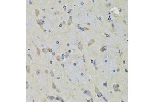 Immunohistochemistry of paraffin-embedded rat brain using RAE1 antibody (ABIN5974056) at dilution of 1/100 (40x lens). (RAE1 anticorps)