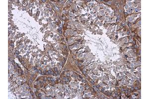 IHC-P Image mTOR antibody [C3], C-term detects mTOR protein at cytoplasm in mouse testis by immunohistochemical analysis.