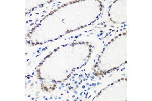 Immunohistochemistry of paraffin-embedded human stomach using HTATSF1 antibody at dilution of 1:100 (40x lens). (HTATSF1 anticorps)