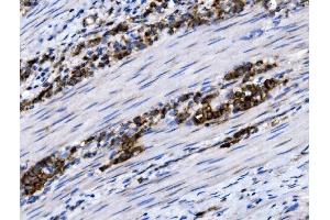 IHC analysis of NKCC1/SLC12A2 using anti-NKCC1/SLC12A2 antibody (ABIN7602602).