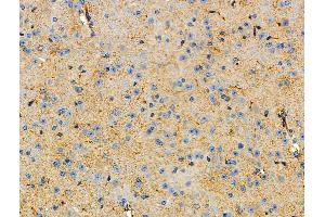 ABIN6264641 and ABIN6277740 at 1/100 staining Mouse brain tissue by IHC-P. (Raptor anticorps  (C-Term))