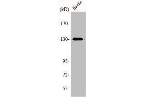 Western Blot analysis of HuvEc cells using AZI1 Polyclonal Antibody (AZI1 anticorps  (Internal Region))