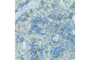 Immunohistochemistry of paraffin-embedded rat spleen using TJP2 antibody. (TJP2 anticorps)
