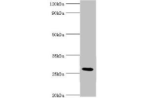 Western blot All lanes: C4b-binding protein beta chain antibody at 6 μg/mL + Mouse liver tissue Secondary Goat polyclonal to rabbit IgG at 1/10000 dilution Predicted band size: 28 kDa Observed band size: 28 kDa (C4BPB anticorps  (AA 18-252))