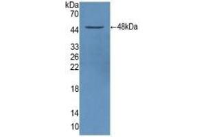 Detection of Recombinant a1AT, Human using Polyclonal Antibody to Alpha-1-Antitrypsin (a1AT)