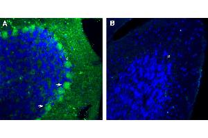 Free-floating frozen brain sections from a paraformaldehyde-perfused mouse were incubated with Anti-Plexin B1 (extracellular) Antibody (ABIN7885236, 1:300), followed by goat anti-rabbit secondary antibody conjugated to Alexa Fluor® 488 (green). (PLXNB1 anticorps  (Extracellular, N-Term))