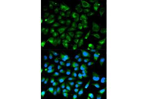 Immunofluorescence analysis of HeLa cell using PRKAR1A antibody. (PRKAR1A anticorps)