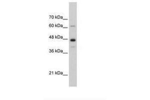 Image no. 1 for anti-Nuclear RNA Export Factor 1 (NXF1) (AA 78-127) antibody (ABIN6736311) (NXF1 anticorps  (AA 78-127))