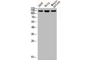 Western blot analysis of 293T Hela mouse-spleen lysis using Phospho-IRS-1 (S312) antibody. (IRS1 anticorps  (pSer312))