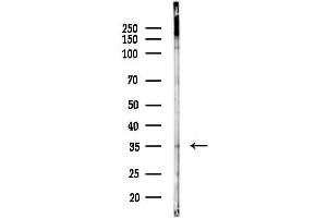 Western blot analysis of lysates from PC12 cells(starvation 24h treatment), using C Antibody at 1/1000 dilution.