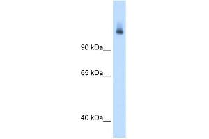 WB Suggested Anti-CPS1 Antibody Titration:  1.