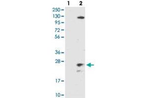Western blot analysis of Lane 1: Negative control (vector only transfected HEK293T lysate), Lane 2: Over-expression Lysate (Co-expressed with a C-terminal myc-DDK tag (~3. (TMEM186 anticorps)