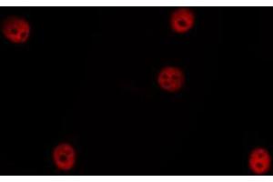 ABIN6266524 staining HepG2 by IF/ICC.