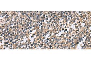 Immunohistochemistry of paraffin-embedded Human tonsil tissue using CSRP2 Polyclonal Antibody at dilution of 1:60(x200) (CSRP2 anticorps)