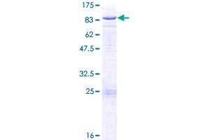 Image no. 1 for UDP-N-Acetyl-alpha-D-Galactosamine:polypeptide N-Acetylgalactosaminyltransferase 14 (GalNAc-T14) (GALNT14) (AA 1-552) protein (GST tag) (ABIN1354738)