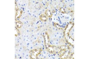 Immunohistochemistry of paraffin-embedded rat kidney using CGB7 antibody at dilution of 1:100 (x40 lens). (CGB7 anticorps)