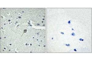 Immunohistochemistry analysis of paraffin-embedded human brain tissue, using PTHR1 Antibody.