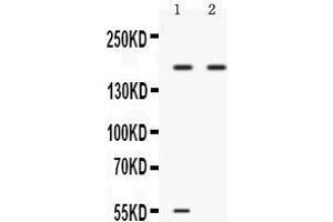 Western blot analysis of Ceruloplasmin expression in 22RV1 whole cell lysates (lane 1) and A549 whole cell lysates (lane 2). (Ceruloplasmin anticorps  (AA 20-259))