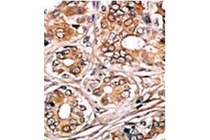 Image no. 1 for anti-Retinoblastoma 1 (RB1) (pSer780) antibody (ABIN358213) (Retinoblastoma 1 anticorps  (pSer780))