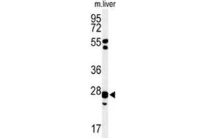Western Blotting (WB) image for anti-Glutathione S-Transferase kappa 1 (GSTK1) antibody (ABIN3004354) (GSTK1 anticorps)