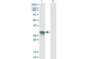 Western Blot analysis of CD83 expression in transfected 293T cell line by CD83 monoclonal antibody (M01), clone 3G10-1F4.
