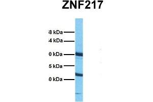 Host:  Rabbit  Target Name:  ZNF217  Sample Tissue:  Human HepG2  Antibody Dilution:  1. (ZNF217 anticorps  (Middle Region))