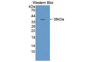 Western blot analysis of the recombinant protein. (NUP50 anticorps  (AA 134-393))