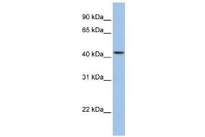 WB Suggested Anti-ZNF202  Antibody Titration: 0. (ZNF202 anticorps  (Middle Region))