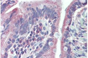 Small intestine, Human: Formalin-Fixed, Paraffin-Embedded (FFPE)