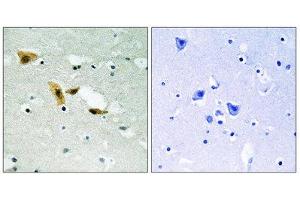 Immunohistochemistry (IHC) image for anti-Aprataxin and PNKP Like Factor (APLF) (Ser116) antibody (ABIN1848316) (APLF anticorps  (Ser116))
