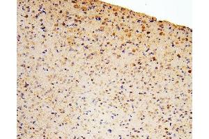 IHC analysis of GLI2 using anti-GLI2 antibody (ABIN6719569).