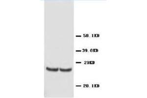 Western blot analysis of rat kidney tissue lysis using TIMP4 antibody (TIMP4 anticorps  (C-Term))