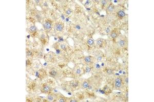 Immunohistochemistry of paraffin-embedded human liver injury using CALD1 antibody. (Caldesmon anticorps  (AA 1-240))