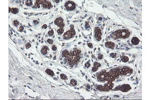 Immunohistochemistry (IHC) image for anti-Diphthamide Biosynthesis Protein 2 (DPH2) antibody (ABIN1497892)