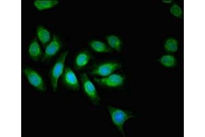 Immunofluorescent analysis of A549 cells using ABIN7143732 at dilution of 1:100 and Alexa Fluor 488-congugated AffiniPure Goat Anti-Rabbit IgG(H+L)
