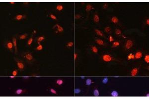 Immunofluorescence analysis of U2OS cells using Phospho-γH2A. (gamma H2AX anticorps  (pSer139))