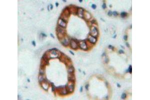 IHC-P analysis of Kidney tissue, with DAB staining. (Nephrin anticorps  (AA 27-234))