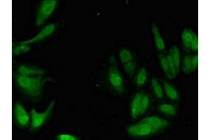 Immunofluorescent analysis of Hela cells using ABIN7169141 at dilution of 1:100 and Alexa Fluor 488-congugated AffiniPure Goat Anti-Rabbit IgG(H+L)