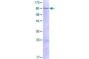 Image no. 1 for Zinc Finger Protein 792 (ZNF792) (AA 1-553) protein (GST tag) (ABIN1326447)