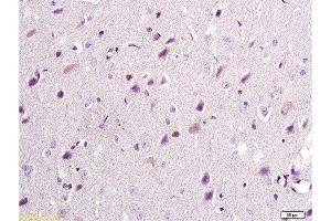 Formalin-fixed and paraffin embedded: rat brain tissue labeled with Anti-NR2B/NMDAR2B Polyclonal Antibody, Unconjugated  at 1:300, followed by conjugation to the secondary antibody and DAB staining (GRIN2B anticorps  (AA 451-550))