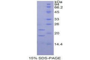SDS-PAGE (SDS) image for Placenta Growth Factor (PGF) (AA 24-158) protein (His tag) (ABIN1880010)