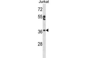 Western Blotting (WB) image for anti-Ovo-Like 1 (OVOL1) antibody (ABIN2998129) (OVOL1 anticorps)