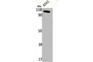 Western Blot analysis of K562 cells using CLC-6 Polyclonal Antibody (CLCN6 anticorps  (Internal Region))