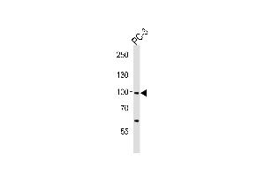Western blot analysis of lysate from PC-3 cell line, using SC Antibody (Center) 8568c.